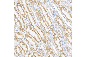 Immunofluorescence analysis of NIH/3T3 cells using RMDN3 Rabbit pAb (ABIN6127274, ABIN6146979, ABIN6146981 and ABIN6221512) at dilution of 1:250 (40x lens).