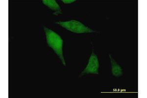 Immunofluorescence of purified MaxPab antibody to AGGF1 on HeLa cell. (AGGF1 抗体  (AA 1-714))