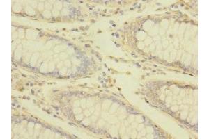 Immunohistochemistry (IHC) image for anti-Transient Receptor Potential Cation Channel, Subfamily M, Member 7 (TRPM7) (AA 756-855) antibody (ABIN7172869)
