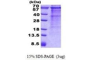 Figure annotation denotes ug of protein loaded and % gel used. (MAVS 蛋白)