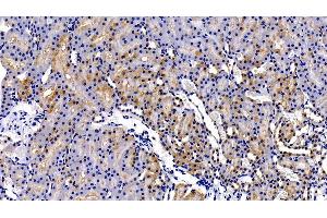 Detection of MMP7 in Rat Kidney Tissue using Polyclonal Antibody to Matrix Metalloproteinase 7 (MMP7) (MMP7 抗体  (AA 1-267))