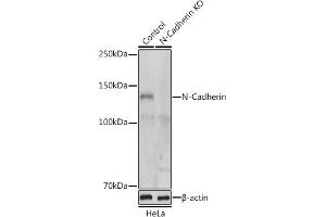 Western blot analysis of extracts from normal (control) and N-Cadherin knockout (KO) HeLa cells, using N-Cadherin antibody (ABIN1684127, ABIN1514384, ABIN5663657 and ABIN6213846) at 1:500 dilution. (N-Cadherin 抗体  (AA 450-550))