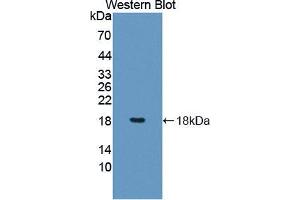Western blot analysis of the recombinant protein. (PDCD5 抗体  (AA 2-125))