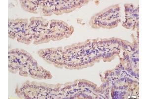 Formalin-fixed and paraffin embedded mouse intestine labeled with Anti-Rad51 Polyclonal Antibody, Unconjugated (ABIN1715101) at 1:200 followed by conjugation to the secondary antibody and DAB staining (RAD51 抗体  (AA 65-170))