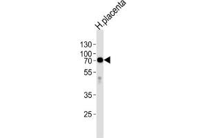 Western Blotting (WB) image for anti-Alkaline Phosphatase (ALP) antibody (ABIN2998256) (Alkaline Phosphatase 抗体)