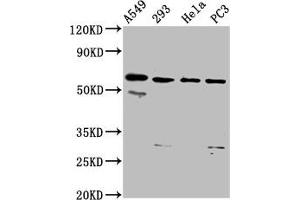 Western Blot Positive WB detected in: A549 whole cell lysate, 293 whole cell lysate, Hela whole cell lysate, PC-3 whole cell lysate All lanes: DDX28 antibody at 6. (DDX28 抗体  (AA 71-206))