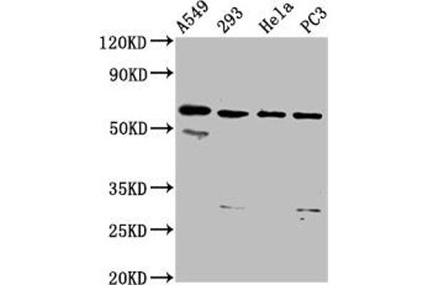 DDX28 抗体  (AA 71-206)