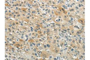 Immunohistochemistry (IHC) image for anti-XK, Kell Blood Group Complex Subunit-Related Family, Member 3 (XKR3) antibody (ABIN7193074)