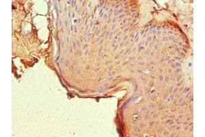 Immunohistochemistry of paraffin-embedded human skin tissue using ABIN7161902 at dilution of 1:100 (NR2C1 抗体  (AA 1-240))