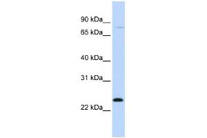 WB Suggested Anti-MX1 Antibody Titration: 0. (MX1 抗体  (C-Term))