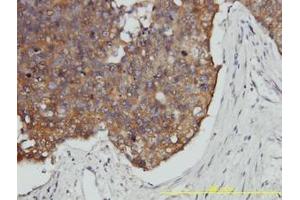 Image no. 2 for anti-Prefoldin Subunit 3 (PFDN3) (AA 1-198) antibody (ABIN466118) (VBP1 抗体  (AA 1-198))