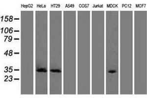 Western blot analysis of extracts (35 µg) from 9 different cell lines by using anti-CDK5 monoclonal antibody. (CDK5 抗体)