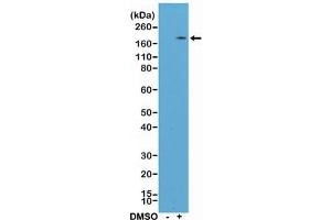 Western blot testing of lysate from human HL60 cells, nontreated (-) or treated (+) with DMSO, with recombinant CD11b antibody at 1:400 dilution.