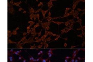 Immunofluorescence analysis of NIH/3T3 cells using P Glycoprotein Polyclonal Antibody at dilution of 1:100. (P-Glycoprotein 抗体)