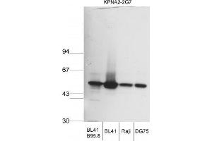 Image no. 1 for anti-Karyopherin alpha 2 (RAG Cohort 1, Importin alpha 1) (KPNA2) antibody (ABIN108571) (KPNA2 抗体)