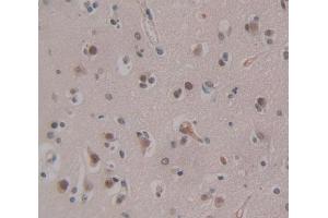 Used in DAB staining on fromalin fixed paraffin- embedded Kidney tissue (CHD5 抗体  (AA 712-896))