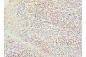 Immunohistochemistry of paraffin-embedded human tonsil tissue using ABIN7172039 at dilution of 1:100 (TXNL4B 抗体  (AA 1-149))
