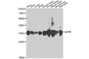 Western blot analysis of extracts of various cell lines, using LDHB antibody (ABIN2563654) at 1:1000 dilution. (LDHB 抗体)