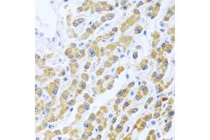 Immunohistochemistry of paraffin-embedded human liver using MANF antibody at dilution of 1:100 (40x lens). (MANF 抗体)