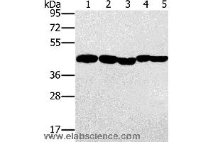 Western blot analysis of Hela, skov3 and A549 cell, mouse liver and human ovarian cancer tissue, using PON1 Polyclonal Antibody at dilution of 1:500 (PON1 抗体)
