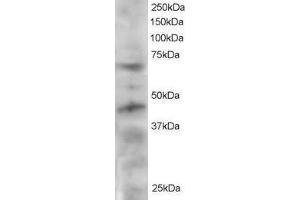ABIN2560349 staining (2µg/ml) of HeLa lysate (RIPA buffer, 30µg total protein per lane). (TRF1 抗体  (C-Term))