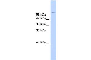 WB Suggested Anti-DYSF Antibody Titration:  0. (Dysferlin 抗体  (N-Term))