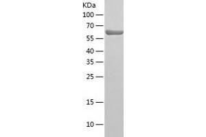 NARS Protein (AA 1-548) (His tag)