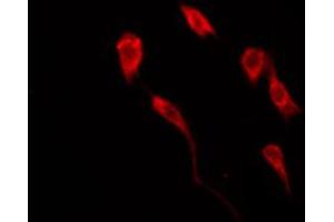 ABIN6267486 staining COS7 by IF/ICC. (IRS1 抗体  (pSer639))