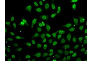 Immunofluorescence analysis of A549 cells using GCA antibody (ABIN5974261). (Grancalcin 抗体)