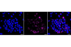 Immunocytochemical staining of HeLa cells with INA antibody (ABIN7799117), 1:1,000).