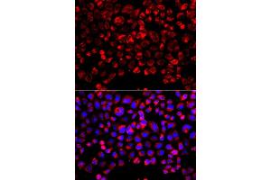 Immunofluorescence analysis of A549 cell using SULT1E1 antibody. (SULT1E1 抗体)