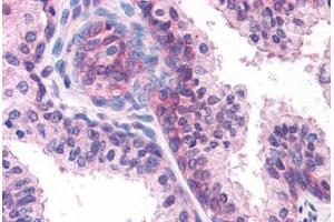 Anti-DHRS7 antibody  ABIN1048499 IHC staining of human prostate. (DHRS7 抗体  (Internal Region))