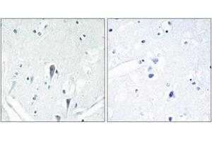 Immunohistochemistry analysis of paraffin-embedded human brain, using IRAK3 Antibody. (IRAK3 抗体  (AA 491-540))