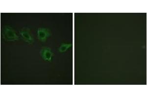Immunofluorescence analysis of A549 cells, using MYPT1 (Phospho-Thr696) Antibody. (PPP1R12A 抗体  (pThr696))