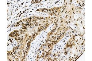 IHC analysis of Emerin using anti-Emerin antibody (ABIN4886569).
