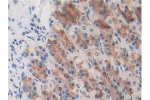 DAB staining on IHC-P; Samples: Rat Stomach Tissue (GSTK1 抗体  (AA 20-214))