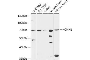Western blot analysis of extracts of various cell lines, using KCNN1 antibody (ABIN6130514, ABIN6142765, ABIN6142767 and ABIN6224976) at 1:3000 dilution. (KCNN1 抗体  (AA 1-90))