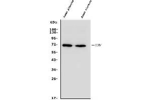 Western blot analysis of ALPP using anti-ALPP antibody (ABIN4886453).