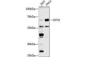 Western blot analysis of extracts of various cell lines, using GPC6 antibody (ABIN1680073, ABIN1680074, ABIN5664142 and ABIN6219786) at 1:1000 dilution. (Glypican 6 抗体  (AA 320-530))