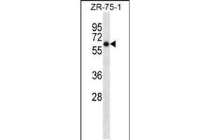Western blot analysis in ZR-75-1 cell line lysates (35ug/lane). (Arylsulfatase D 抗体  (C-Term))