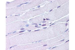 Anti-NUR77 antibody IHC of human skeletal muscle. (NR4A1 抗体  (AA 251-266))