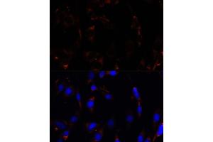 Immunofluorescence analysis of C6 cells using RPL26 antibody (ABIN7269999) at dilution of 1:100. (RPL26 抗体  (AA 20-95))