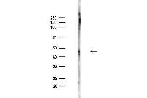 anti-Egl-9 Family Hypoxia Inducible Factor 1 (EGLN1) (pSer125) antibody