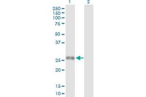 Western Blot analysis of PPP2R3B expression in transfected 293T cell line by PPP2R3B MaxPab polyclonal antibody. (PPP2R3B 抗体  (AA 1-176))