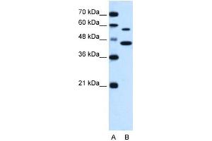 Western Blotting (WB) image for anti-Solute Carrier Family 39 (Metal Ion Transporter), Member 5 (SLC39A5) antibody (ABIN635721)