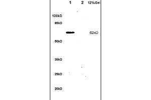 SDS-PAGE (SDS) image for anti-Interleukin 1 Receptor, Type I (IL1R1) (AA 481-569) antibody (ABIN747743)