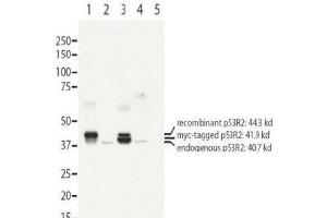 Image no. 1 for anti-Ribonucleotide Reductase M2 B (TP53 Inducible) (RRM2B) (N-Term) antibody (ABIN401481) (RRM2B 抗体  (N-Term))