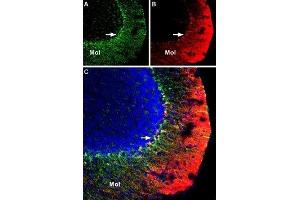Immunohistochemistry (IHC) image for anti-Potassium Voltage-Gated Channel, Shaker-Related Subfamily, Member 3 (KCNA3) (AA 263-276), (Extracellular) antibody (Biotin) (ABIN7043522)