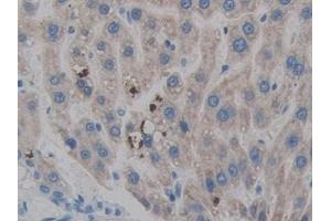 Detection of HPSE in Rat Liver Tissue using Polyclonal Antibody to Heparanase (HPSE) (HPSE 抗体  (AA 40-188))