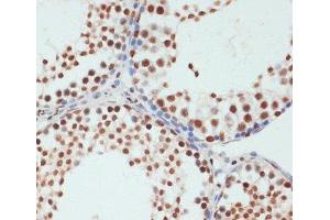 Immunohistochemistry of paraffin-embedded Rat testis using Phospho-POLR2A(S5) Polyclonal Antibody at dilution of 1:100 (40x lens). (POLR2A/RPB1 抗体  (pSer5))